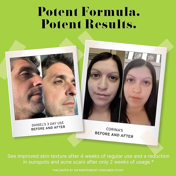 No B.S. Caffeine Eye Cream with Pure Hyaluronic Acid & Plant Based Squalane Oil, Under Eye Cream for Dark Circles & Puffiness, Skin Care for Women & Men, Travel Size, 0.5 FL Oz, and CoQ10 for Wrinkles-VivaGrace Women