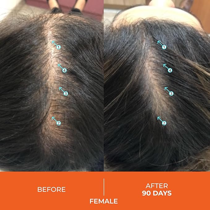 DS Labs Revita Hair Vitamin Gummies - Thickening & Strengthening Hair Supplement with Biotin, Zinc, Iron, Magnesium, Vitamin D & Melatonin, Fuller, Healthier-Looking Hair, Vegan & Gluten-Free-VivaGrace Women