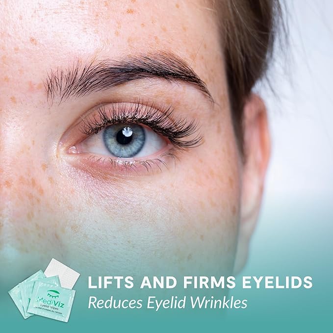 EyeLove Eyelid Cleanser Wipes - 30 Single-Use Towelettes - Gentle, Hypoallergenic Eyelid Wipes for Soothing Itchy Eyes, Removing Debris & Eye Makeup, and More