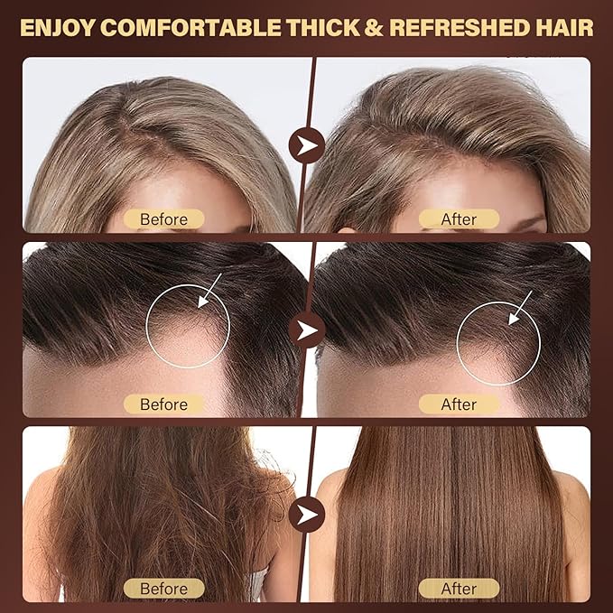 Scalp Scrub, 2-in-1 Scalp Exfoliator & Clarifying Shampoo for Dandruff, Dry, Itchy Scalp & Hair Growth, Batana Oil & Rosemary Scalp Treatment with Scalp Massager for Buildup & Thinning Hair, 10.93 oz-VivaGrace Women