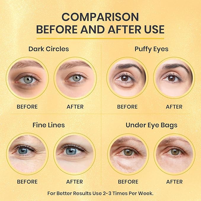 24k Gold Under Eye Patches for Puffy Eyes (7 Pairs) – Gold Foil Under Eye Masks for Dark Circle with Betaine, Hyaluronic Acid – Skincare Eye Bags Patches Treatment for Men & Women-VivaGrace Women