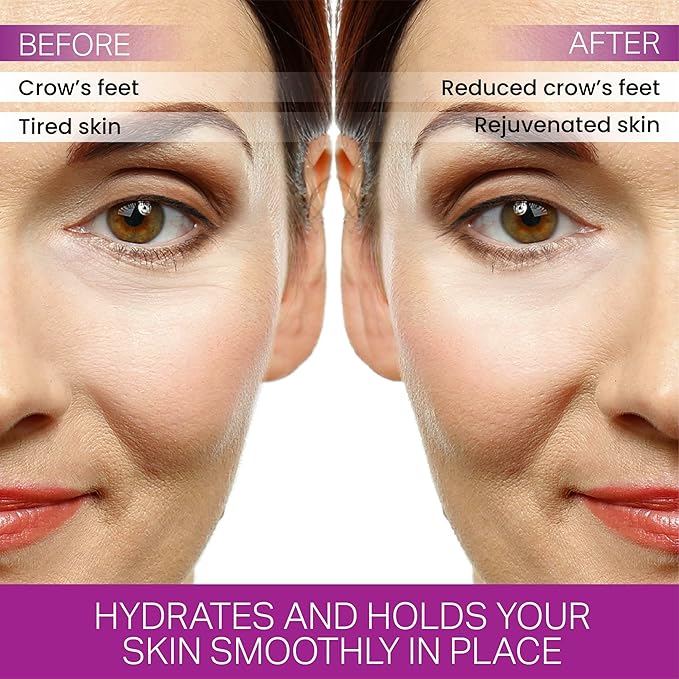 Furlesse Crows Wrinkle Patches, Overnight Eye Patches for Wrinkles and Crow’s Feet Lines, Non-invasive Anti-Wrinkle Patches, Anti-aging Skincare, 60 Patches, 30-Day Use-VivaGrace Women