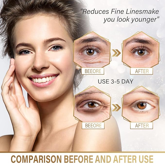 Under Eye Masks - 24K Gold Under Eye Patches for Puffy Eyes and Dark Circles - Under Eye Treatment, Fine Lines & Puffiness, 30 Pairs Collagen Eye Gel Pads for Personal Care-VivaGrace Women