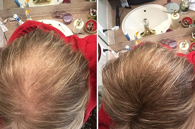 Quick Fix For Thinning Hair and Bald Spot. Get 10X Fuller Hair Instantly. All-Natural Hair Building Fiber For Hair. Trial Size (10-Day Supply). Light Brown-VivaGrace Women