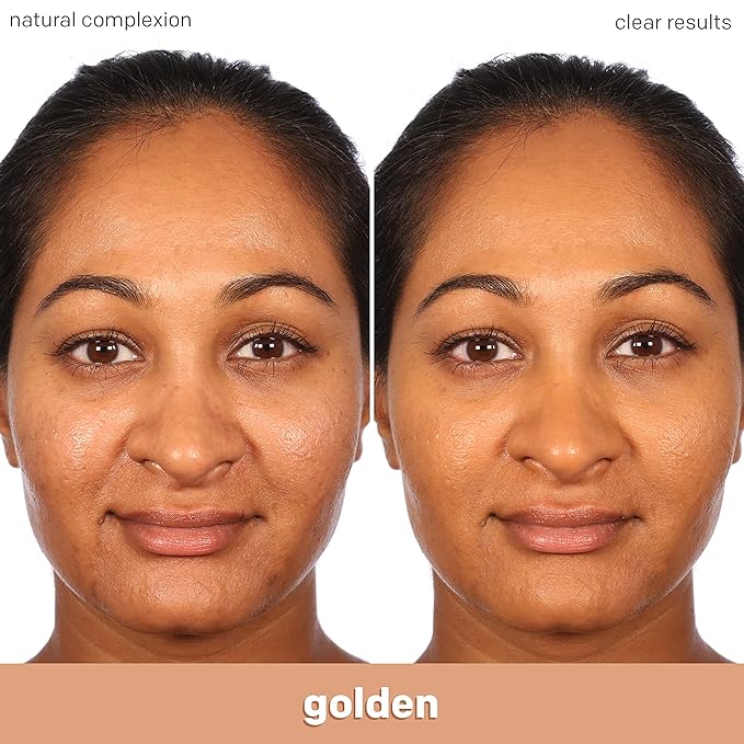 Almay Clear Complexion Acne Foundation Makeup with Salicylic Acid - Lightweight, Medium Coverage, Hypoallergenic, Fragrance-Free, for Sensitive Skin, 705 Toast, 1 fl oz.-VivaGrace Women