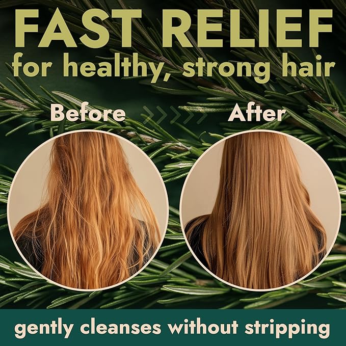 Rosemary Shampoo and Conditioner Set Infused with Tea Tree & Rosemary Oils for Scalp Relief and Hair Growth | Sulfate Free, Soothes Dry Scalp, Boosts Shine + Free Scalp Brush | 16.9 fl oz-VivaGrace Women