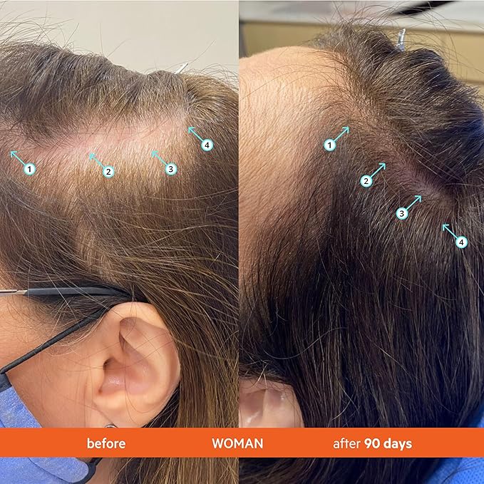 DS Labs Revita Shampoo and Conditioner – High-Performance Hair Density Kit, Volumizing, Thickening, Fuller, Sulfate & Silicone Free, For Men & Women, 925mL, Packaging May Vary-VivaGrace Women