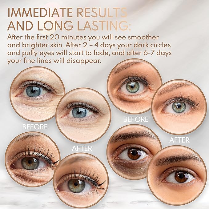 Under Eye Anti-Aging Eye Mask Collagen Patch Treatment for Minimizing Wrinkles, Puffy Eyes, Eye Bags, Dark Circles, Fine Lines Under the Eye, Looking Less Tired, Revitalizing, Moisturizing and-VivaGrace Women