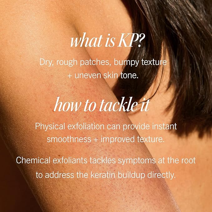 First Aid Beauty - KP Bump Eraser Body Scrub with 10% AHA, Keratosis Pilaris Skin Exfoliater with Glycolic and Lactic acids, Helps Reduce Chicken Skin Bumps, Safe for Sensitive Skin, 4 oz-VivaGrace Women