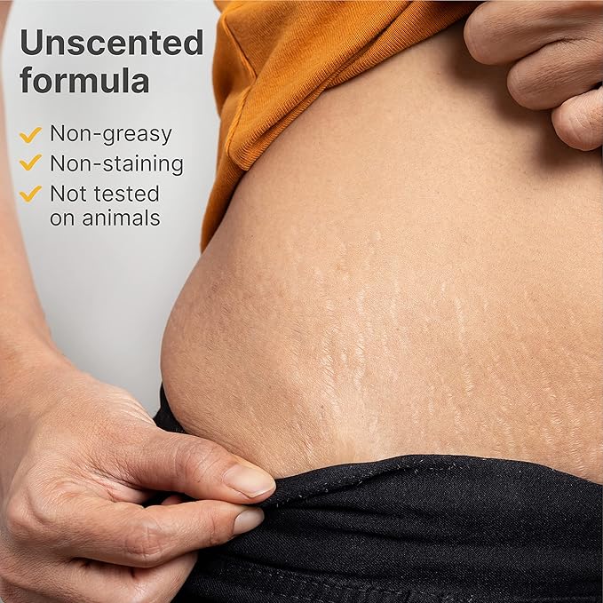 TriLASTIN-SR Intensive Stretch Mark Cream (5.5oz) Bundle with Nipple & Lip Balm (3pk) | Fast-Acting Stretch Marks Cream with Absorption Enhancing Serum | Breastfeeding & Ingesting Safe Balm-VivaGrace Women