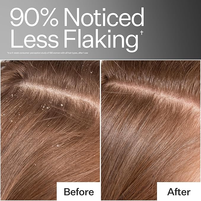 ACT+ ACRE Cold Processed Scalp Detox Oil - Sulfate-Free Care for Flaky, Dry and Itchy Scalp - Promotes Thicker, Fuller-Looking Hair-VivaGrace Women